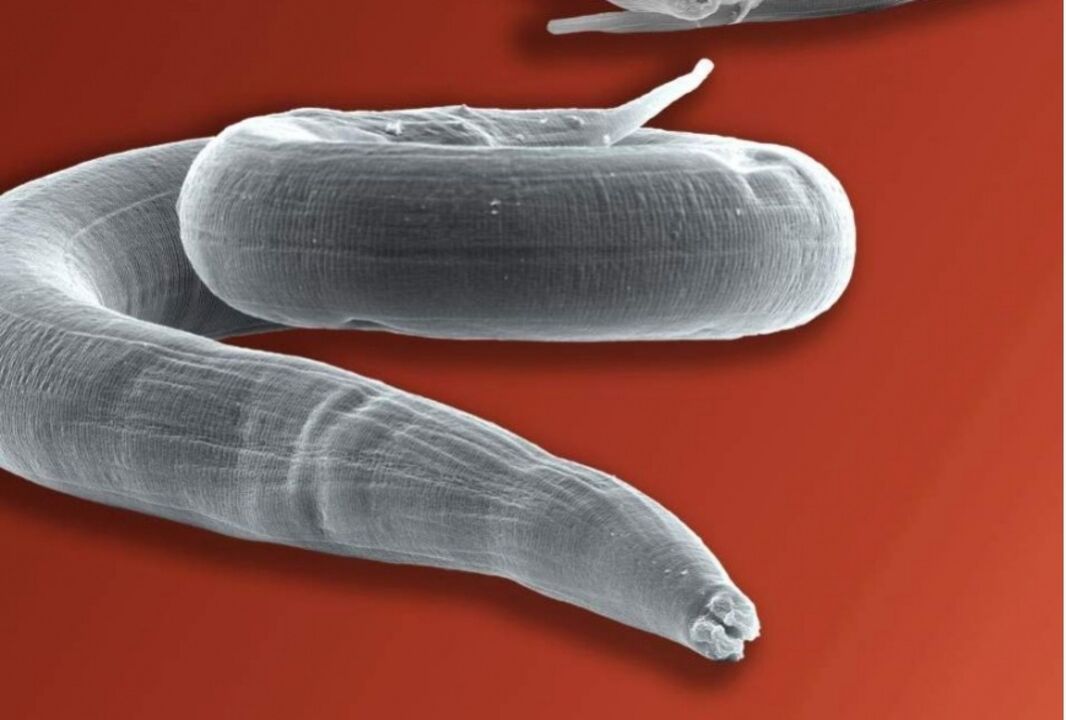 pinworm z ľudského tela
