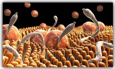 parazity vo vnútri tela